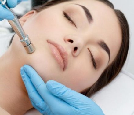 Diamond microdermabrasion 1